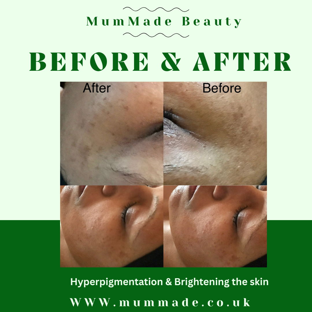 Skin Repair & Brightening Facial - 1 hr